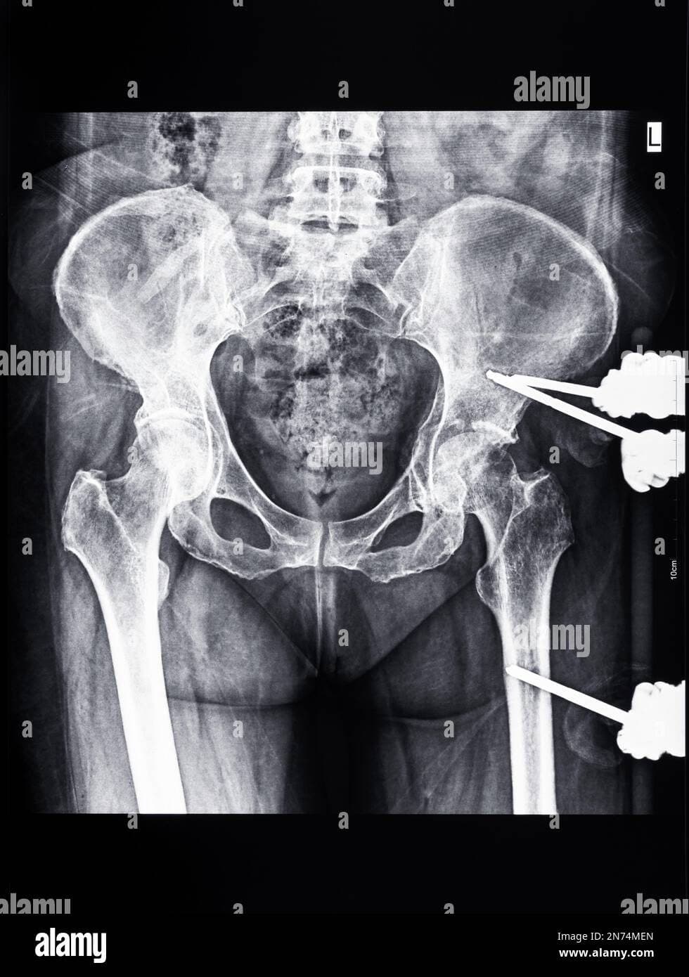 Suporte Cel Veic Xray